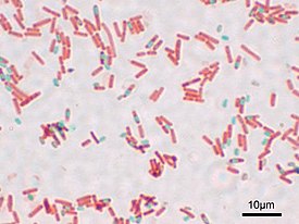 Клетки Bacillus subtilis (споры окрашены в синий цвет)