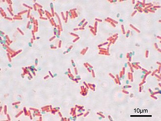 Sporulating Bacillus subtilis Bacillus subtilis Spore.jpg