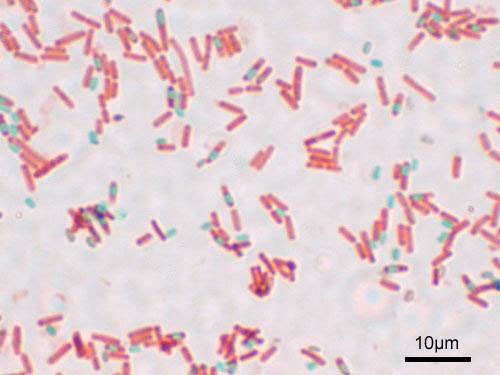 An endospore stain of the cell Bacillus subtilis showing endospores as green and the vegetative cell as red