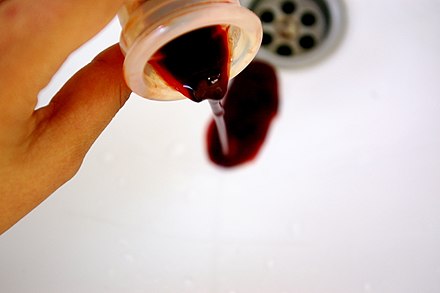 Кровотечение в домашних условиях. Менструационного чаша с кровью. Менструационная чаша с кровью. Сгусток менструальной крови.