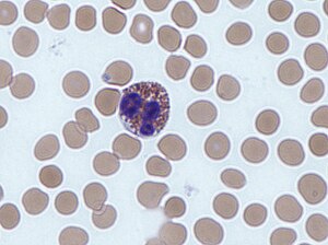 Eosinophil 2.jpg