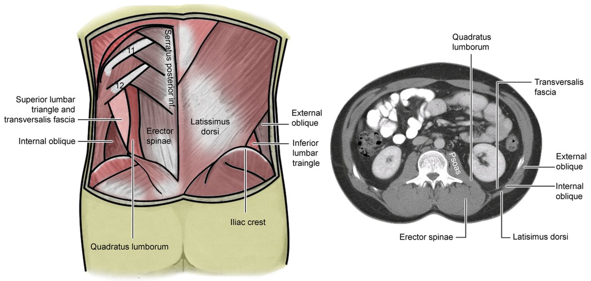 Lumbar triangle