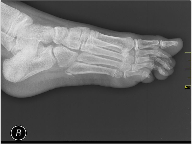 File:Medical X-Ray imaging VHN07 nevit.jpg