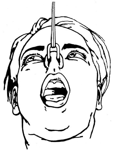 File:Nosehook-drawing-bw.png