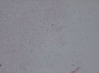 <i>Pantoea agglomerans</i> Species of bacterium