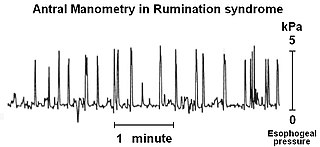 <span class="mw-page-title-main">Rumination syndrome</span> Medical condition