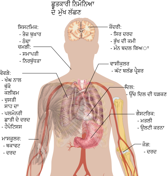 File:Symptoms of pneumonia-pa.svg