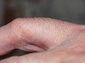 der andere kleine Finger zum Vergleich