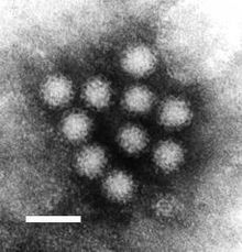 Bilete av noro-virus gjennom elektronmikroskop