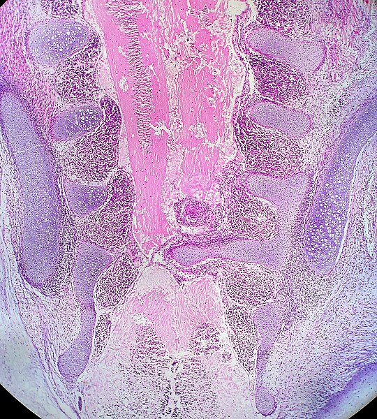 File:Pelvix and Lower Spine of Human Embryo (3460140262).jpg
