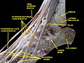 Ankle joint. Deep dissection. Lateral view.