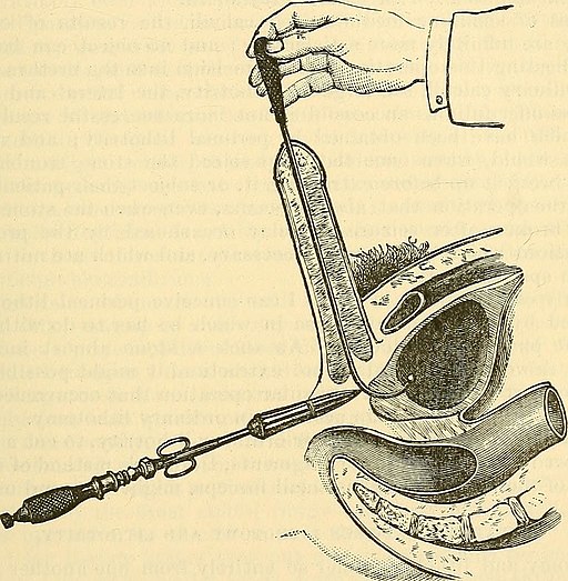 The science and art of surgery - being a treatise on surgical injuries, diseases, and operations (1878) (14780258884)