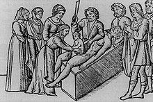 Medieval woodcut depicting the birth of Julius Caesar Woodcut of the Birth of Julius Caesar.jpg