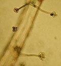 Miniatura para Stachybotrys chartarum