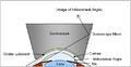 Schema della goniolente di Goldman