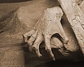 Hand of Guanajuato mummy
