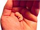 Modell eines 8 Wochen alten menschlichen Embryos in der Hand eines Erwachsenen
