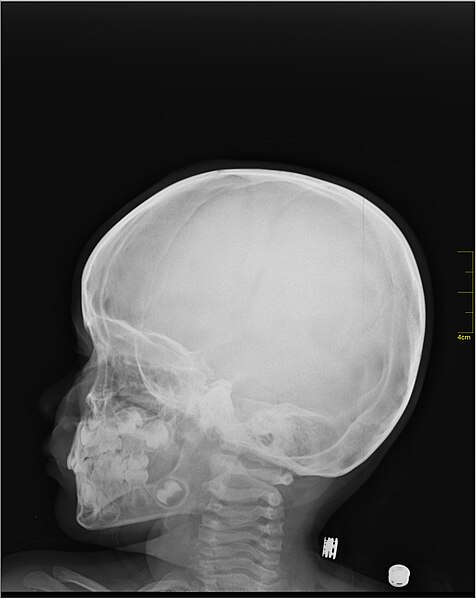 File:Medical X-Ray imaging POK06 nevit.jpg