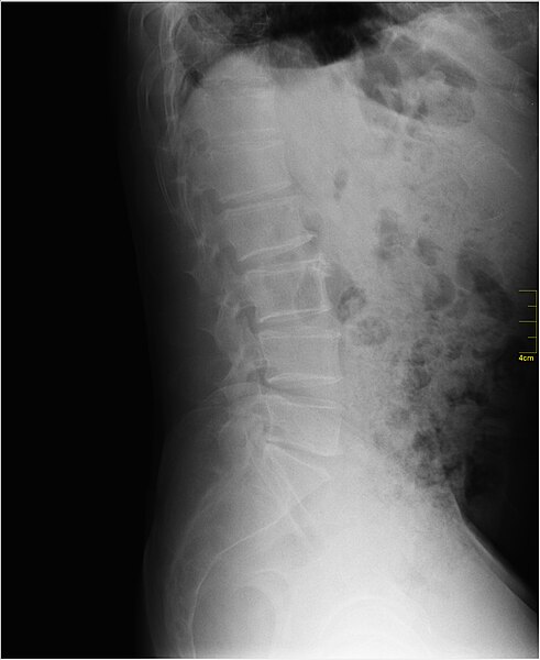File:Medical X-Ray imaging WRS07 nevit.jpg