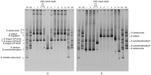 TTGE profiles representing the bifidobacterial diversity of fecal samples journal pone 0050257 g004.png