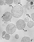 Thumbnail for Acholeplasmataceae