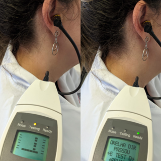 <span class="mw-page-title-main">Otoacoustic emission</span> Sound from the inner ear