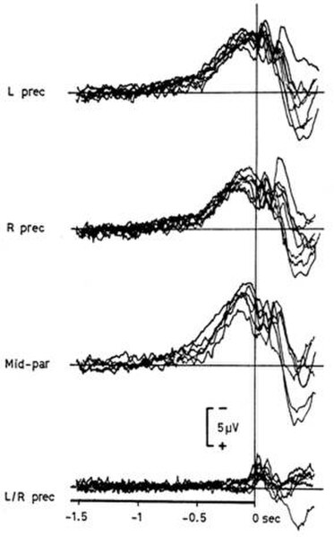 Typical recording of the Bereitschaftspotential that was discovered by Kornhuber and Deecke in 1965). Benjamin Libet investigated whether this neural 