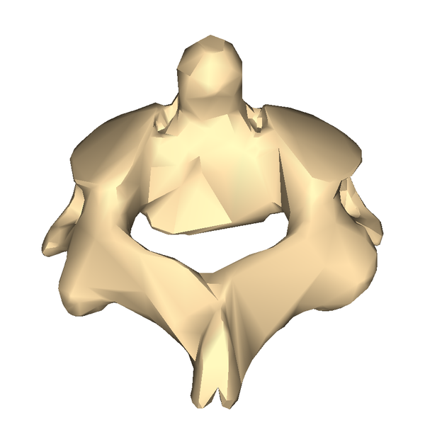 File:Cervical vertebra 2 close-up back2.png