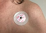 Elektrokardiografi EKG-apparat