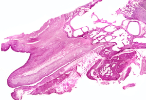 Eustachian Tube