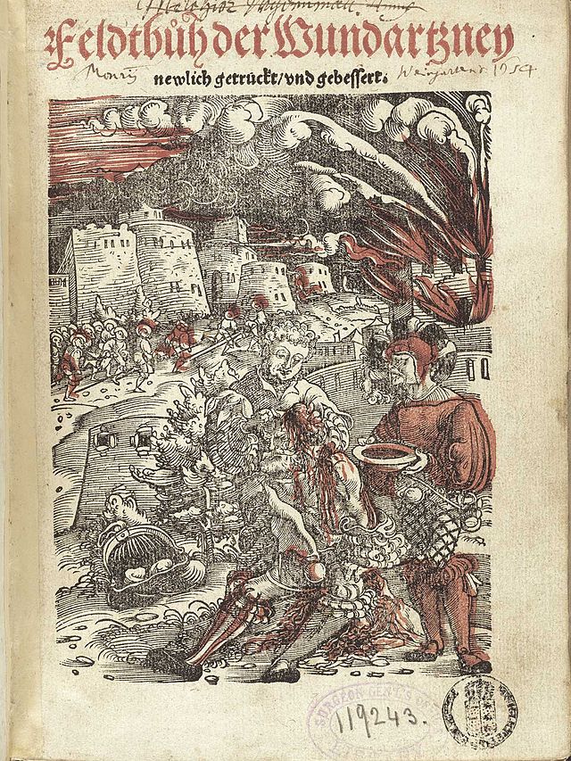 "Feldbuch der Wundarzney" by Hans von Gersdorff