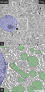 Hepatòcit A) Citoplasma en gris. Nucli pintat en blau. C) Mitocondris en verd. Microscopi electrònic