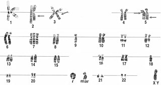 <span class="mw-page-title-main">Ring chromosome</span> Chromosome whose ends have fused together to form a ring