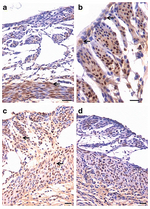 Thumbnail for File:Immuno-localization of PCNA after treatment with progesterone (a–b) and (c–d) follicle stimulating hormone (01).png