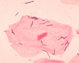 Lactobacillus acidophilus біля вагінальних епітеліальних клітин