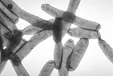 Legionella pneumophila v elektronovém mikroskopu