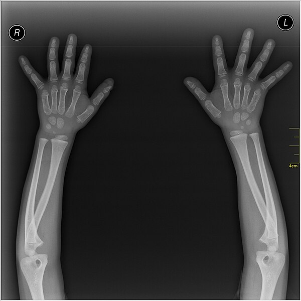 File:Medical X-Ray imaging XBC07 nevit.jpg