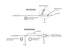 Anatomy of OTW vs. Rx balloon catheter OTW Vs. Rx.jpg
