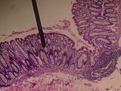 Cross-section microscopic shot of the rectal wall