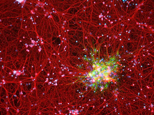 U.S. Jury's Choice Award The Galaxy Within by Dustin Johnsen. A 10x image of cultured mouse cortical neurons and astrocytes in cell culture. Neurons are stained red (MAP2 protein), while astrocytes are stained green (GFAP). As the presumed seat of consciousness, the infinity of questions still surrounding the brain are as nebulous as those surrounding our infinite universe. We are but stars in the end; and in the beginning.