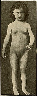 The breast- its anomalies, its diseases, and their treatment (1917) (14754630724).jpg