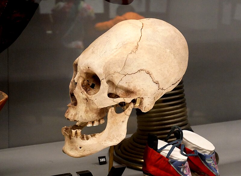 File:Tiwanaku Deformed Skull in the Horniman Museum.jpg