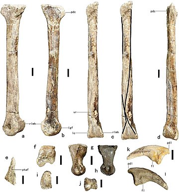 Anomalipes zhaoi