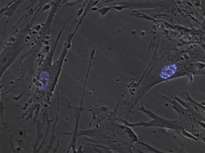 Nuclear bodies in human embryonic lung cells HEL cells + PML3 eCFP.png