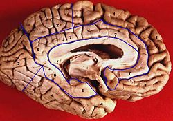 Description de la vue inférieure-médiale du cerveau humain.JPG