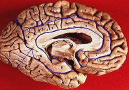 Human brain inferior-medial view description.JPG