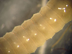 Borsten eines Regenwurms im Mikroskop