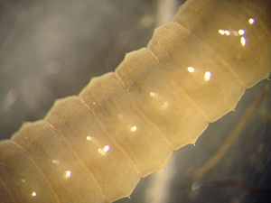 Bristles of an earthworm under the microscope