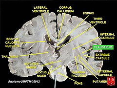 Что такое путамен 8 букв. Путамен мозга это. Putamen анатомия. Claustrum в мозгу. Nucleus ruber на препарате.