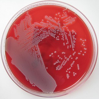 Staphylococcus aureus среда. Золотистый стафилококк на кровяном агаре. Золотистый стафилококк микробиология. S. aureus золотистый стафилококк. Сапрофитный стафилококк.